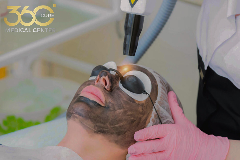 سيدة تتلقى جلسة تقشير الوجه بالليزر الكربوني في عيادة جلدية في أبوظبي.