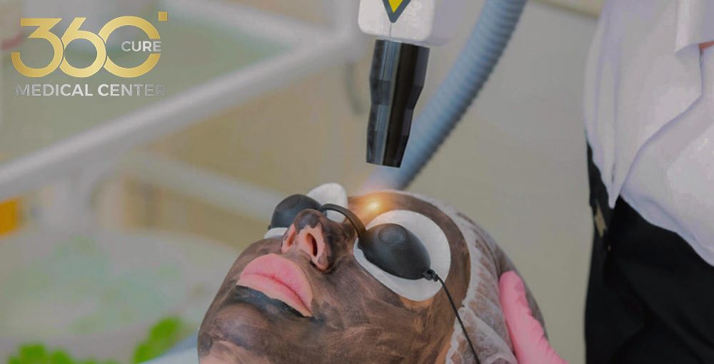 Woman receiving Carbon Laser Facial treatment at a skin clinic in Abu Dhabi.