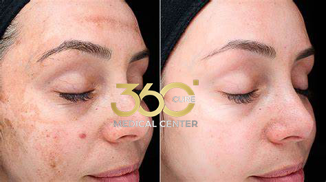 Before and after Dental Implant in Abu Dhabi – natural-looking smile transformation