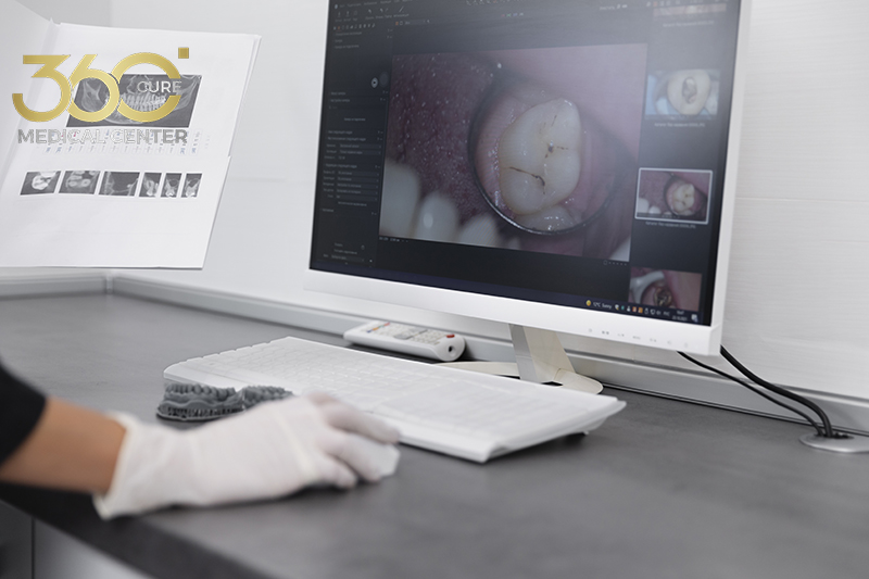 Before and after Dental Implant in Abu Dhabi – natural-looking smile transformation