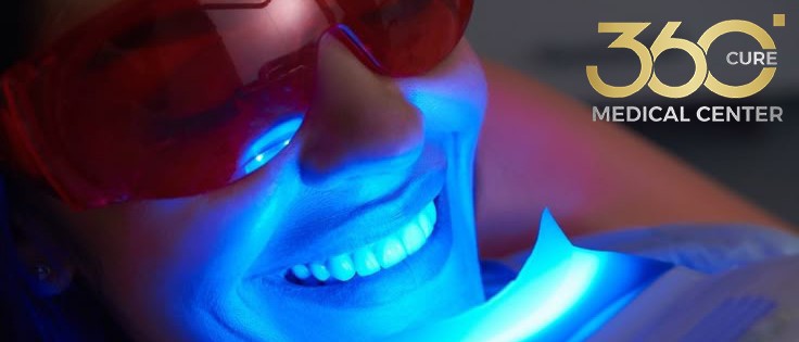 جلسة تبييض أسنان في مركز 360 كيور