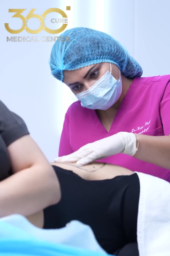 البودي فيلر لنحت الأرداف